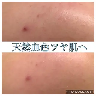 ショート カラー パーマ ヘアアレンジ キッズ ネイル マツエク・マツパ Ensor Clair所属・EnsorClair 代表　野口真央のエステ・リラクイメージ