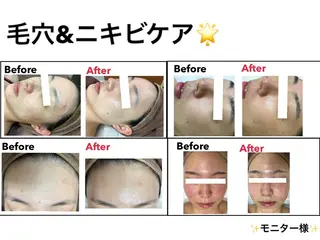 エステティックレイ ビス秋田店 菅野のエステ・リラクイメージ