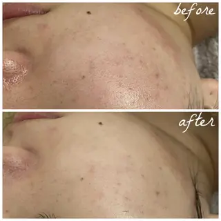 メンズ メナード岐阜市茜部 杉浦のエステ・リラクイメージ