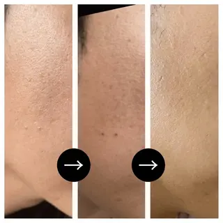 ハーブピーリング専門 muro.のエステ・リラクイメージ