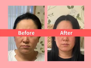 痩身&小顔矯正専門店 Re:Livesのエステ・リラクイメージ