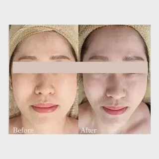 看護師 AYUIのエステ・リラクイメージ