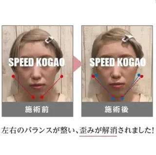 小顔矯正 natsuのエステ・リラクイメージ