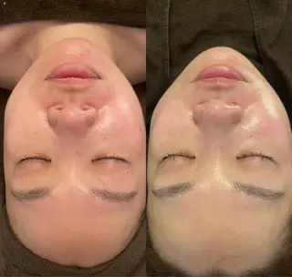 oyam オヤムのエステ・リラクイメージ