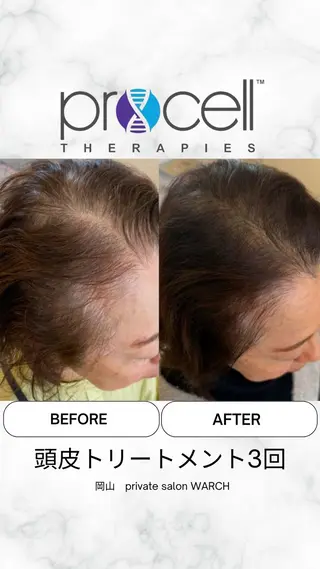 WARCH Marieのその他イメージ