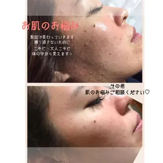 星野 七海のエステ・リラクイメージ