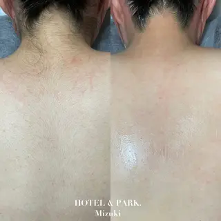 HOTEL&PARK . ワックス脱毛のエステ・リラクイメージ