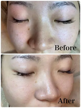 多摩境Beauty Salon  ViVi所属・多摩境ViVi chinamiのエステ・リラクイメージ