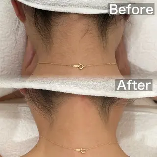 manaka 【lazo】 束本のエステ・リラクイメージ