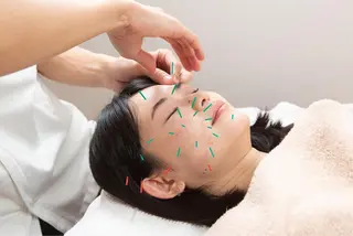 美容鍼とルート治療 iRu 金沢所属・中田 達也のその他イメージ