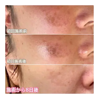 シミ・毛穴ケア専門 Lunaのエステ・リラクイメージ