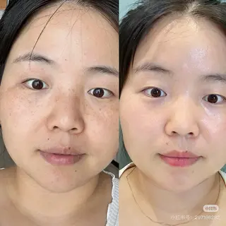 ネイル aliaハイフ&水光ジェットサロン所属・aliaハーブ水光店 エステティシャン募集のエステ・リラクイメージ