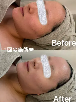 facial salon D 吉沢のエステ・リラクイメージ