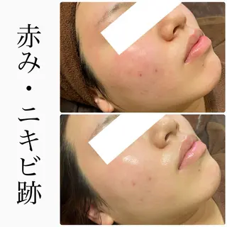 ハーブピーリング専門 BIOEL横浜のエステ・リラクイメージ