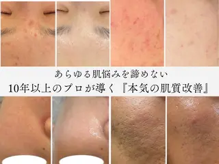 エステサロンNoa所属・肌質改善サロン Noaのエステ・リラクイメージ