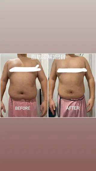 毛穴洗浄・痩身・脱毛 /アルカンジュのエステ・リラクイメージ