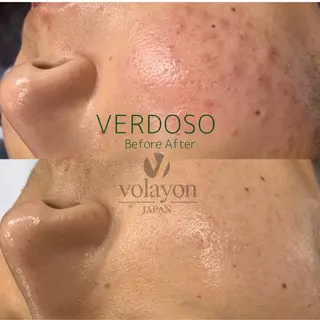 crescent所属・【韓国肌管理・脱毛】 クレセントのその他イメージ