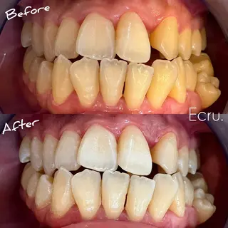 メンズ キッズ ホワイトニングサロン Ecru所属・ホワイトニングサロン Ecru エクリュのその他イメージ