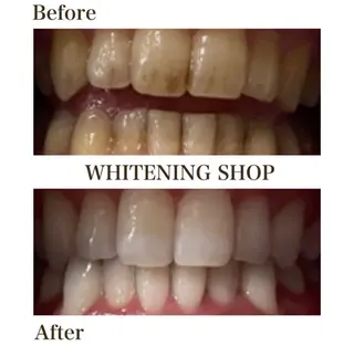 ホワイトニングショップ伊丹店所属・ホワイトニング ショップ伊丹店のその他イメージ