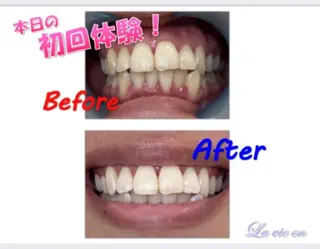 セルフホワイトニングサロン　ラヴィアン所属・ホワイトニングサロン La vie enのその他イメージ