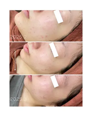 肌質改善ワックス専門 yukiのエステ・リラクイメージ