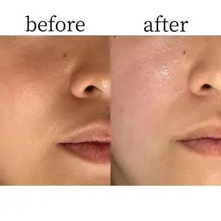 abbellina×UNO出雲塩冶店《ウノ》所属・フェイシャルエステ 🫧琉衣のエステ・リラクイメージ