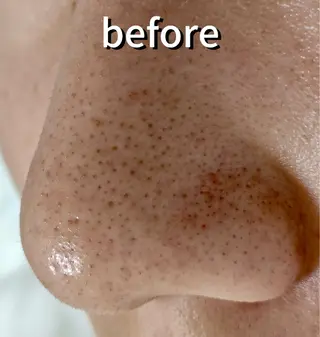 麻布十番エステサロン WhiteAzabuのエステ・リラクイメージ