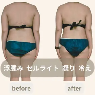 小顔艶肌＆痩身サロン 🍋 Meguのエステ・リラクイメージ