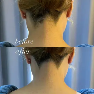 うなじ脱毛/美肌脱毛 LABELのエステ・リラクイメージ