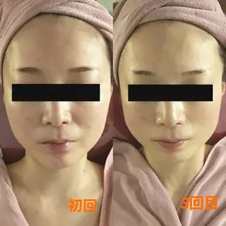 BELLEFINE 💕痩身・小顔・脱毛のエステ・リラクイメージ