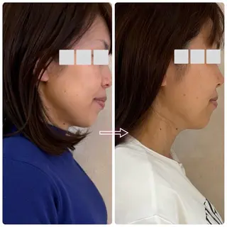 private salon.ohana所属・小顔/ララピール ohanaのエステ・リラクイメージ