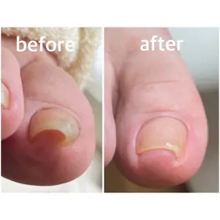 ネイル 足・爪トラブル専門店　foot grace所属・加藤 望のネイルデザイン