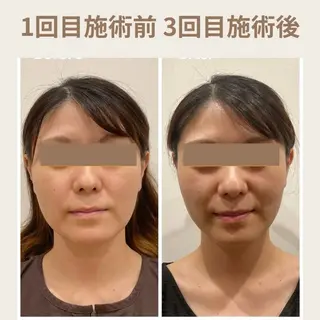 Ayaka🤍 恵比寿/美容鍼/整体のエステ・リラクイメージ