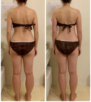 MOKA☆毒出し/ 毛穴/ブライダル専門のエステ・リラクイメージ