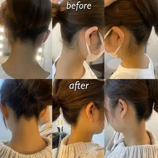 うなじ脱毛/美肌脱毛 LABELのエステ・リラクイメージ