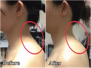 首肩こり専門サロン Kalnicco/カルニッコ所属・首肩こり専門サロン Kalniccoのエステ・リラクイメージ