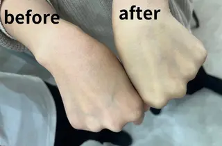 肌分析×パーソナル エステPOLAのその他イメージ