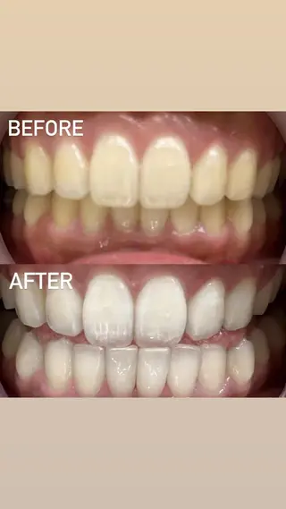 LBSホワイトニング 銀座店💎店長浦和のその他イメージ