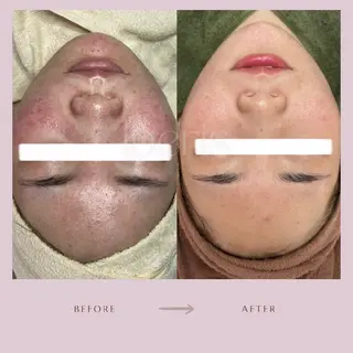 coco whitening＆Beauty所属・阿部 香織のエステ・リラクイメージ