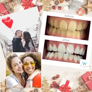 メンズ ホワイトニング ショップ船橋２号店のエステ・リラクイメージ