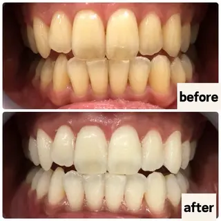 お肌と歯のサロン　Sona Mior所属・藤井 ののみのエステ・リラクイメージ