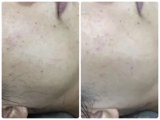 宮野 麻綺のエステ・リラクイメージ