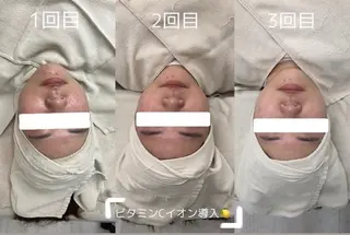 BITSU　PRESS原宿所属・PRESS 中山のエステ・リラクイメージ