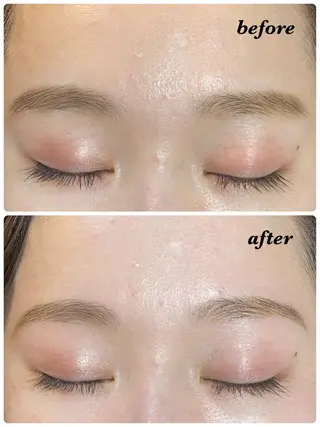 アイブロウ ハーブピーリング/韓国肌管理/フェイシャル/毛穴洗浄/眉毛/顔脱毛【糸脱毛専門】rev所属・ハーブピーリング🌹 毛穴洗浄❤️眉waxのエステ・リラクイメージ