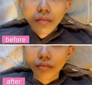 Rosemelia所属・Rosemelia 🌹麻布十番のエステ・リラクイメージ