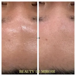 ビューティー ミロワールのエステ・リラクイメージ