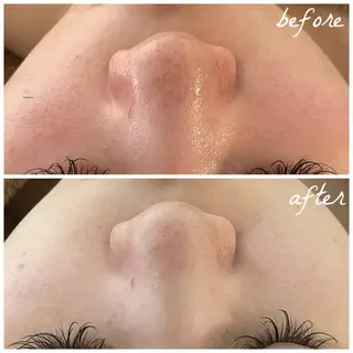 メンズ メナード岐阜市茜部 杉浦のエステ・リラクイメージ