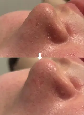 本吉 茉矢のエステ・リラクイメージ