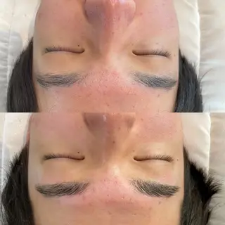 アイブロウ エステティックサロン Liente(リアンテ)所属・Hashimoto .のエステ・リラクイメージ