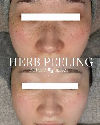 小顔矯正&リンパ専門店EMIER(エミエル)所属・福井二の宮EMIER /ゆきのエステ・リラクイメージ